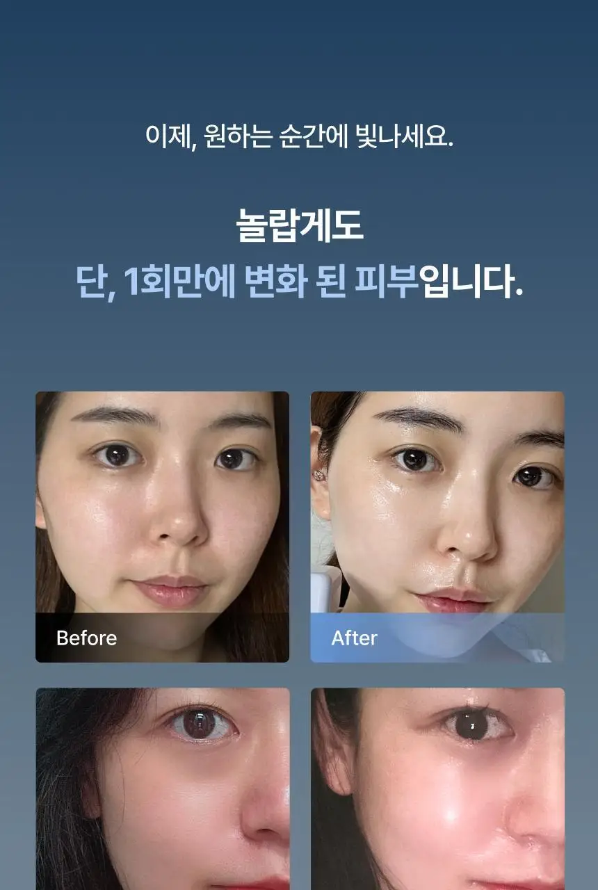 [D-1 스페셜 케어] 톰 원데이 에스테틱 글레이즈드 프로그램 상세페이지 26